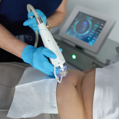 Carousel Microneedling & RF Microneedling Treatments